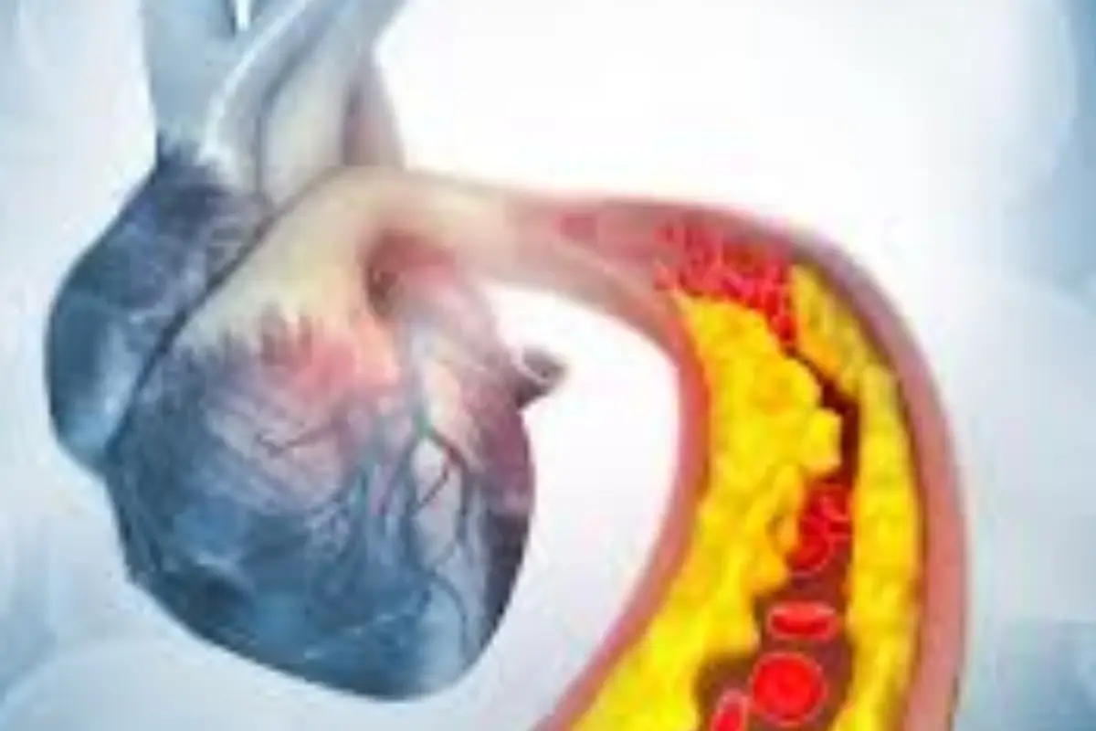 La prevenzione primaria cardiovascolare: ecco cosa significa e perché è vitale per la tua salute