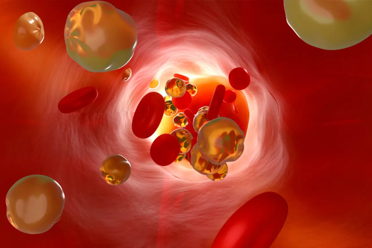 Attenzione a queste malattie silenziose dei vasi sanguigni: sono più comuni di quanto pensi