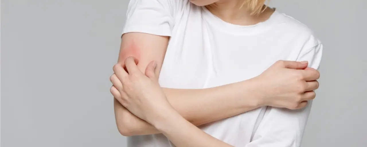 Hai un prurito fastidioso costante? Attenzione a questo tipo di dermatite comune